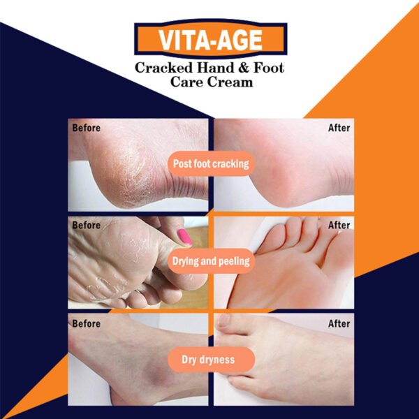 Vita Age Cracked Hand Foot Care Cream 2